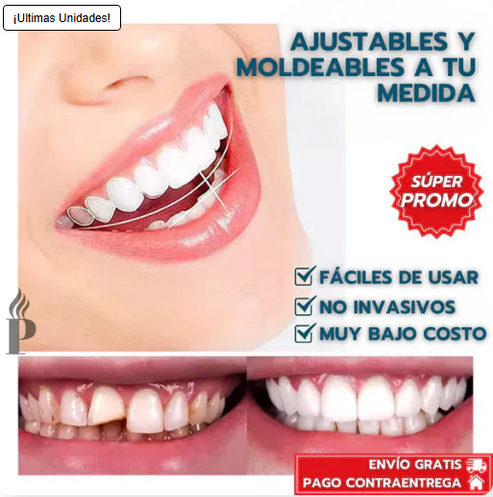 Carillas  SmileInstant™: ocultan manchas, espacios y torceduras en minutos, desde casa