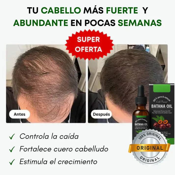 Batana Oil® - Regenerador crecimiento para el cabello